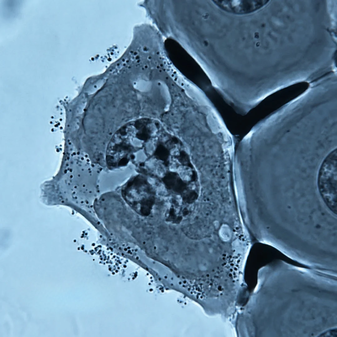 Endothelial Dysfunction Develops